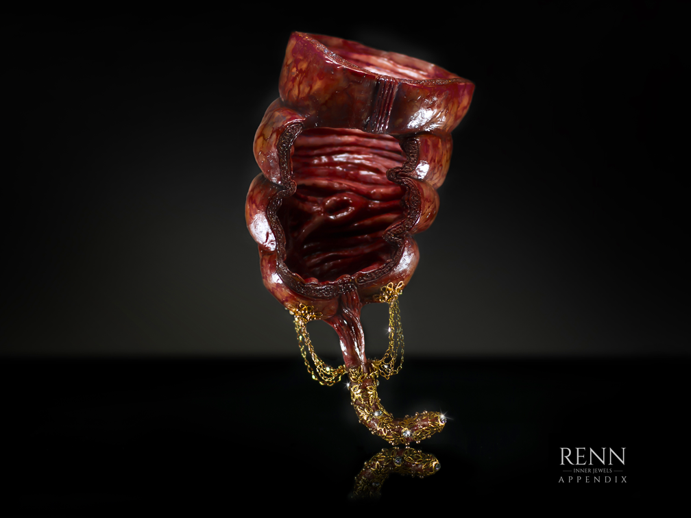 Renn